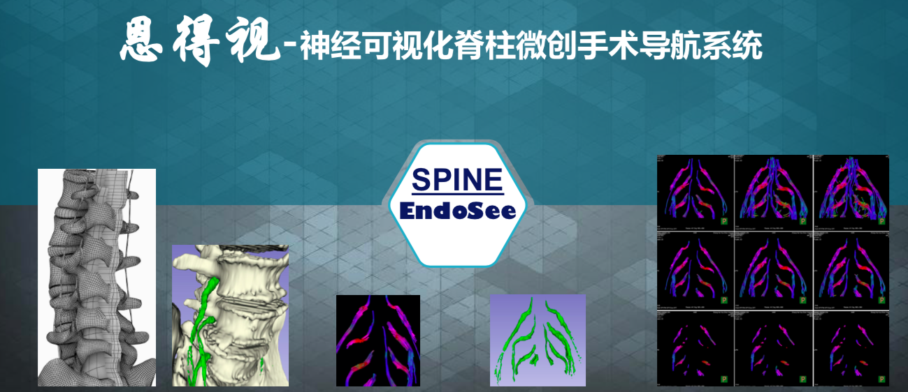 医学信息工程，医疗信息化赛道专业解析_四照花生长速度